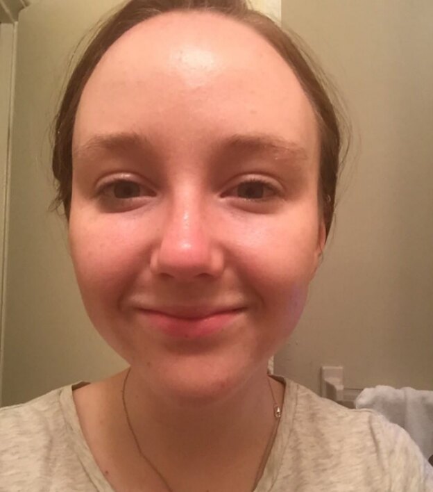 روغن نارگیل برای صورت