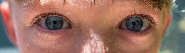 ماسک خانگی مراقبت از پوست های چرب