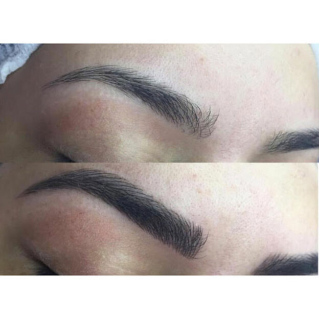 نانو بلیدینگ