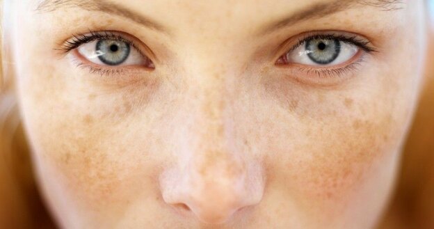 برنزه کردن پوست