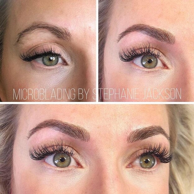  میکروپیگمنتیشن و میکروبلیدینگ 3