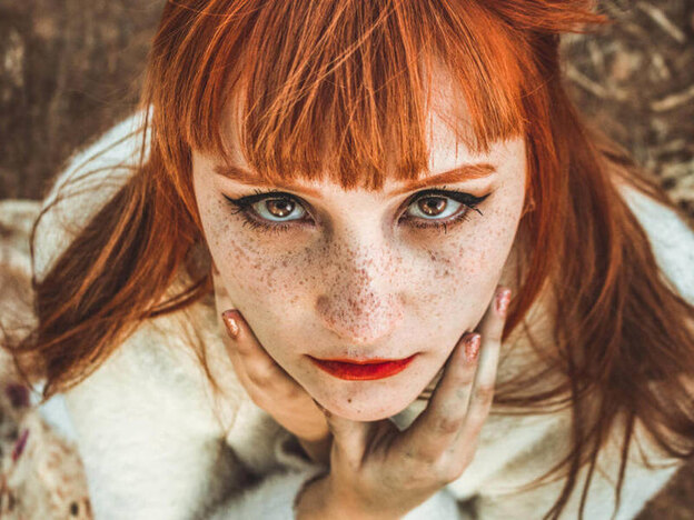  درمان کک و مک 2