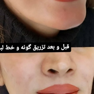 تصویر گالری