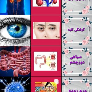 تصویر گالری