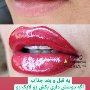 تصویر گالری