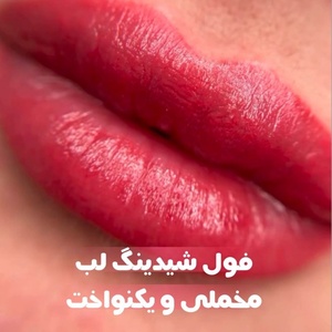 تصویر گالری