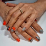 پیوند عبدالله زاده اصل